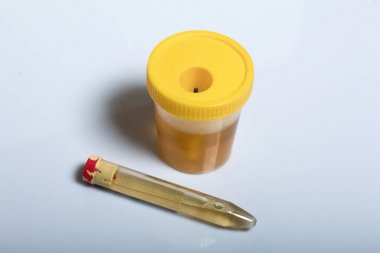 人對氧磷酶1(PON1)酶聯(lián)免疫elisa試劑盒 人對氧磷酶1(PON1)酶聯(lián)免疫elisa試劑盒