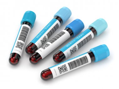 小鼠5羥色胺(5-HT)酶聯(lián)免疫elisa試劑盒 小鼠5羥色胺(5-HT)酶聯(lián)免疫elisa試劑盒
